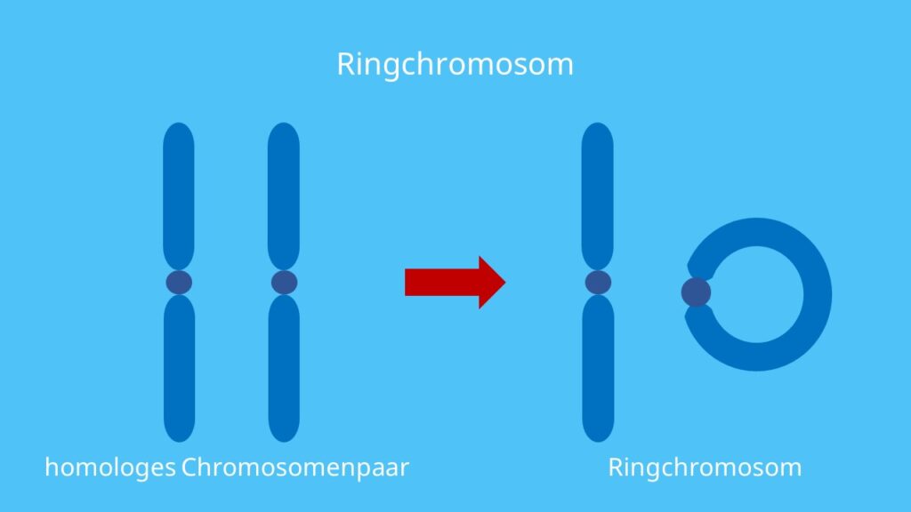 Chromosomenmutation, Chromosomenaberration, Chromosom, Ringchromosom, Turner Syndrom