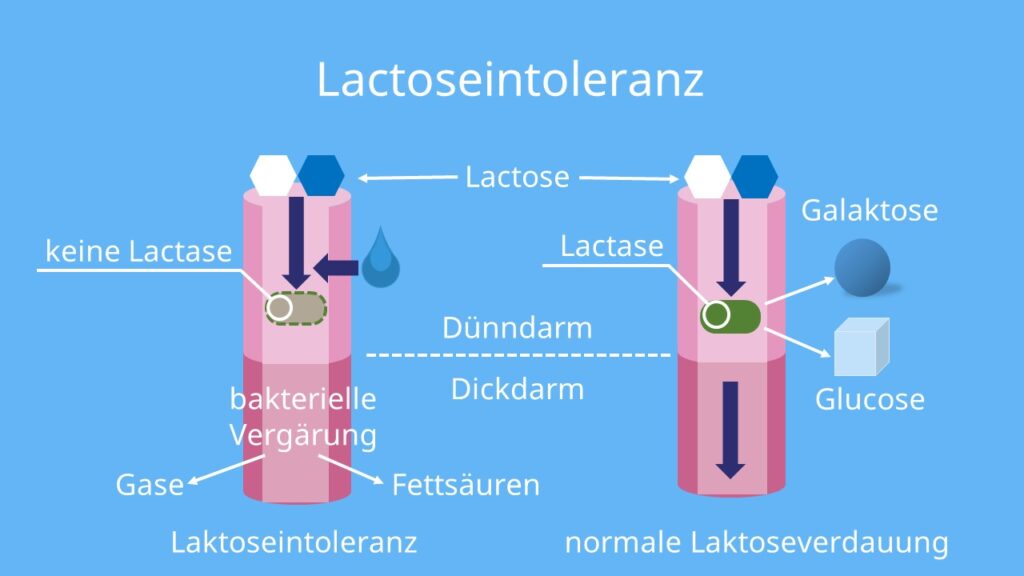 Lactose, Strukturformel, Chemie, Kohlenhydrate, Disaccharid, Haworth, Laktose, Lactoseintoleranz, Laktoseintoleranz