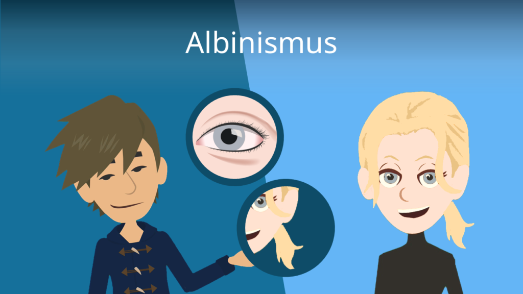 Zum Video: Albinismus